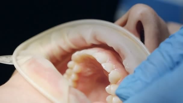 Профгігієна зубів в стоматології Луцьк